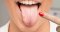 candida